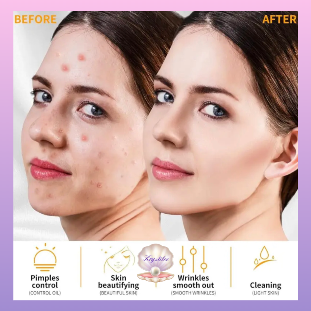 ✨ High Frequency Facial & Capilar Profesional