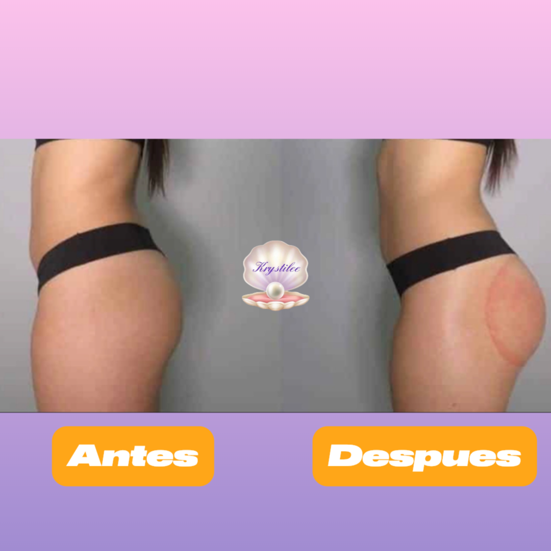 Sistema Profesional de Vacuumterapia Glúteos & Moldeo Corporal