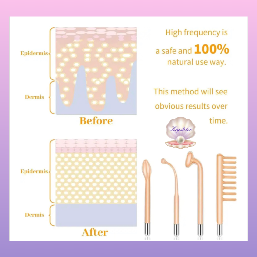 ✨ High Frequency Facial & Capilar Profesional